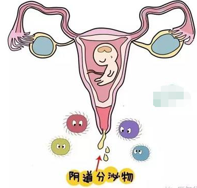 陰道分泌物萝卜AV视频的一般性狀檢查類型