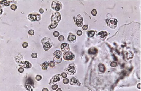 全自動陰道分泌物萝卜AV视频剖析陰道分泌物的潔淨度規範