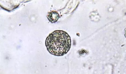 全自動陰道分泌物萝卜AV视频剖析陰道分泌物的潔淨度規範