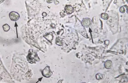 全自動陰道分泌物萝卜AV视频剖析陰道分泌物的潔淨度規範