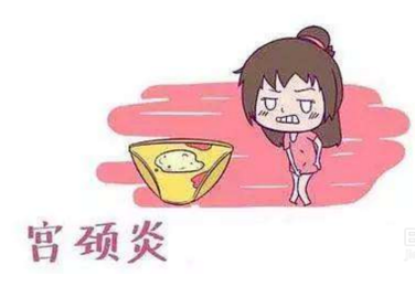 婦科白帶萝卜AV视频廠家分析宮頸炎的症狀