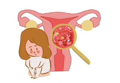 陰道分泌物萝卜AV视频廠家總結病理性的白帶異常有哪些