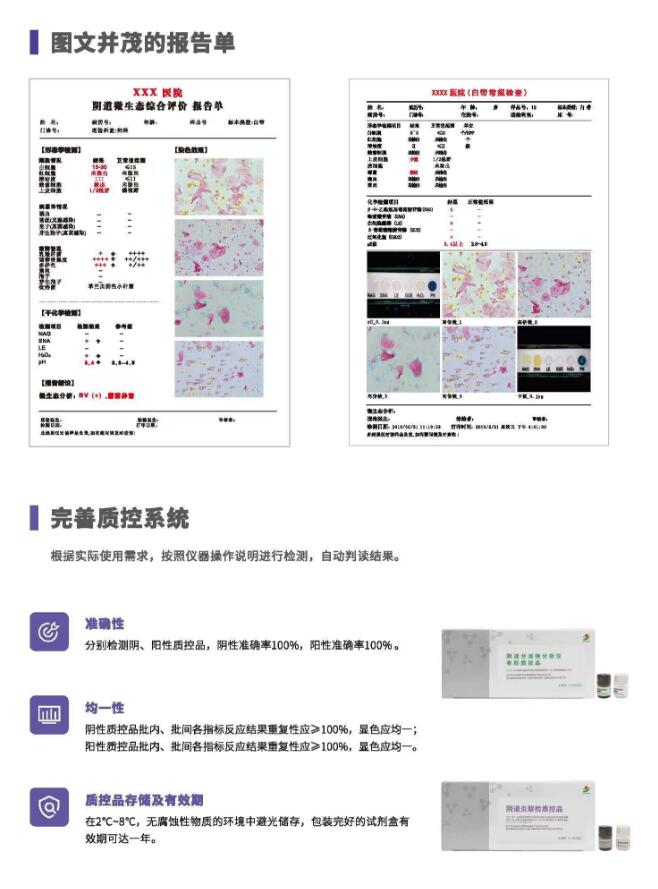 陰道分泌物萝卜视频色版V800報告單