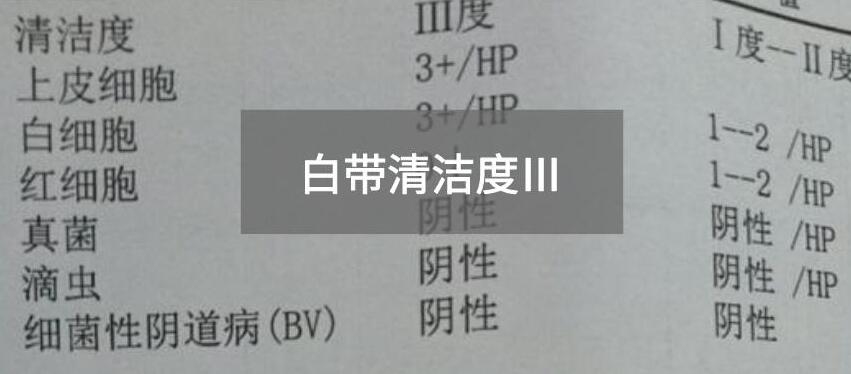 今天快訊！全自動白帶萝卜视频色版生產廠家萝卜视频APP网站為您官方解釋白帶清潔度3的意思